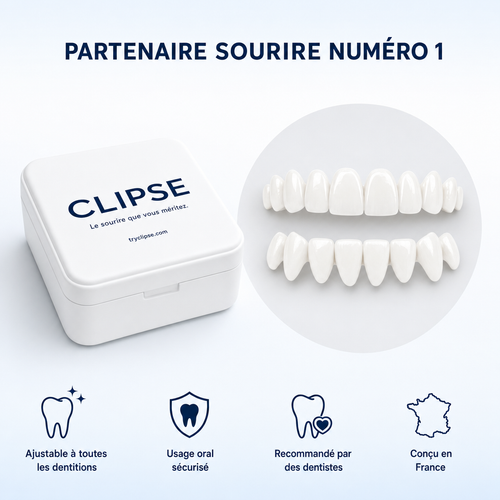 Faccetta dentale superiore