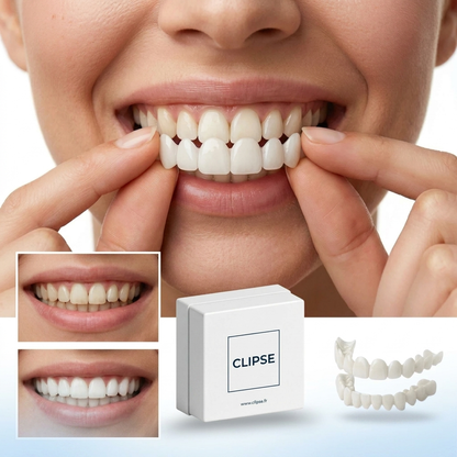 Faccette dentali Clipse®